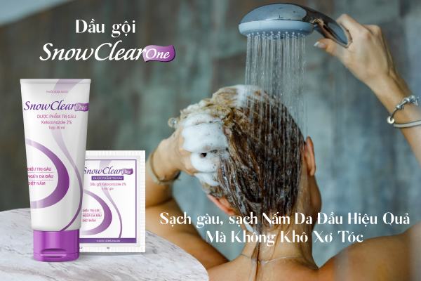 Dầu gội sạch gàu, sạch nấm hiệu quả mà không khô xơ tóc- Ảnh 4.