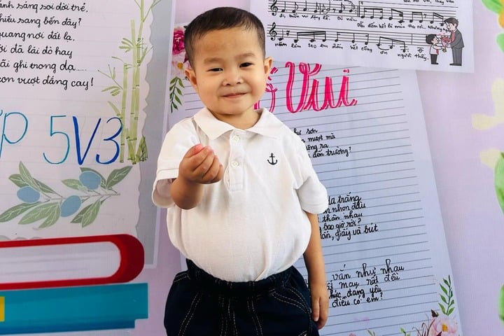 "Giáo sư tí hon" gây sốt mạng và hành trình chiến đấu với bệnh hiếm- Ảnh 1.