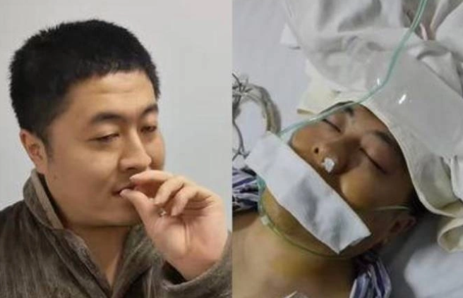 Thường xuyên ngoáy mũi, người đàn ông bị vỡ động mạch, phải mổ cấp cứu- Ảnh 1. Thường xuyên ngoáy mũi, người đàn ông bị vỡ động mạch, phải mổ cấp cứu- Ảnh 1.