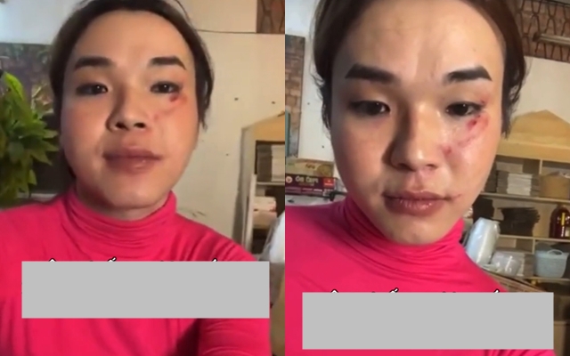 “Thánh gỏi đu đủ” Ty Thy tố bạn trai trộm hơn 7 cây vàng, hành hung: Người đàn ông lên tiếng- Ảnh 2.
