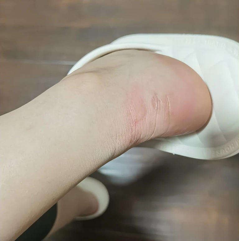 Việc lựa chọn tất giá rẻ có thể ẩn chứa nhiều nguy cơ, từ chất liệu không đảm bảo đến các hóa chất độc hại. Sản phẩm kém chất lượng không chỉ gây khó chịu mà còn có thể dẫn đến các vấn đề sức khỏe nghiêm trọng. 