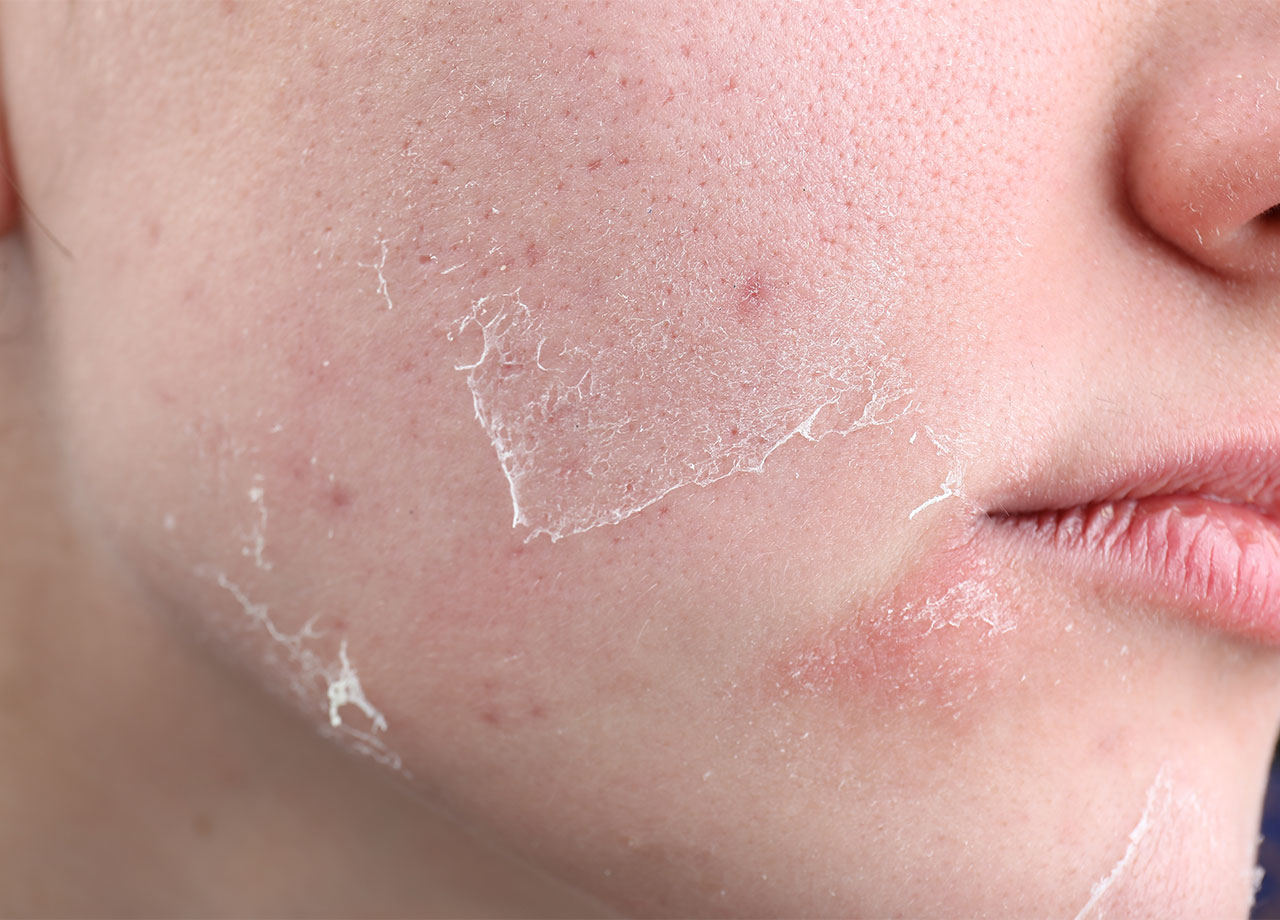 Sau tuổi 40 phụ nữ muốn giữ nhiều collagen trên mặt nhớ tránh 3 thói quen "độc hại", nếu không sẽ lão hóa nhanh, nếp nhăn nhiều- Ảnh 2.