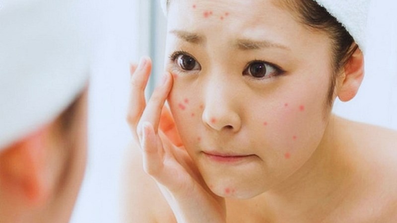 2 sai lầm kinh điển khi chọn mua kem chống nắng khiến da sạm nám, lão hóa nhanh- Ảnh 2.