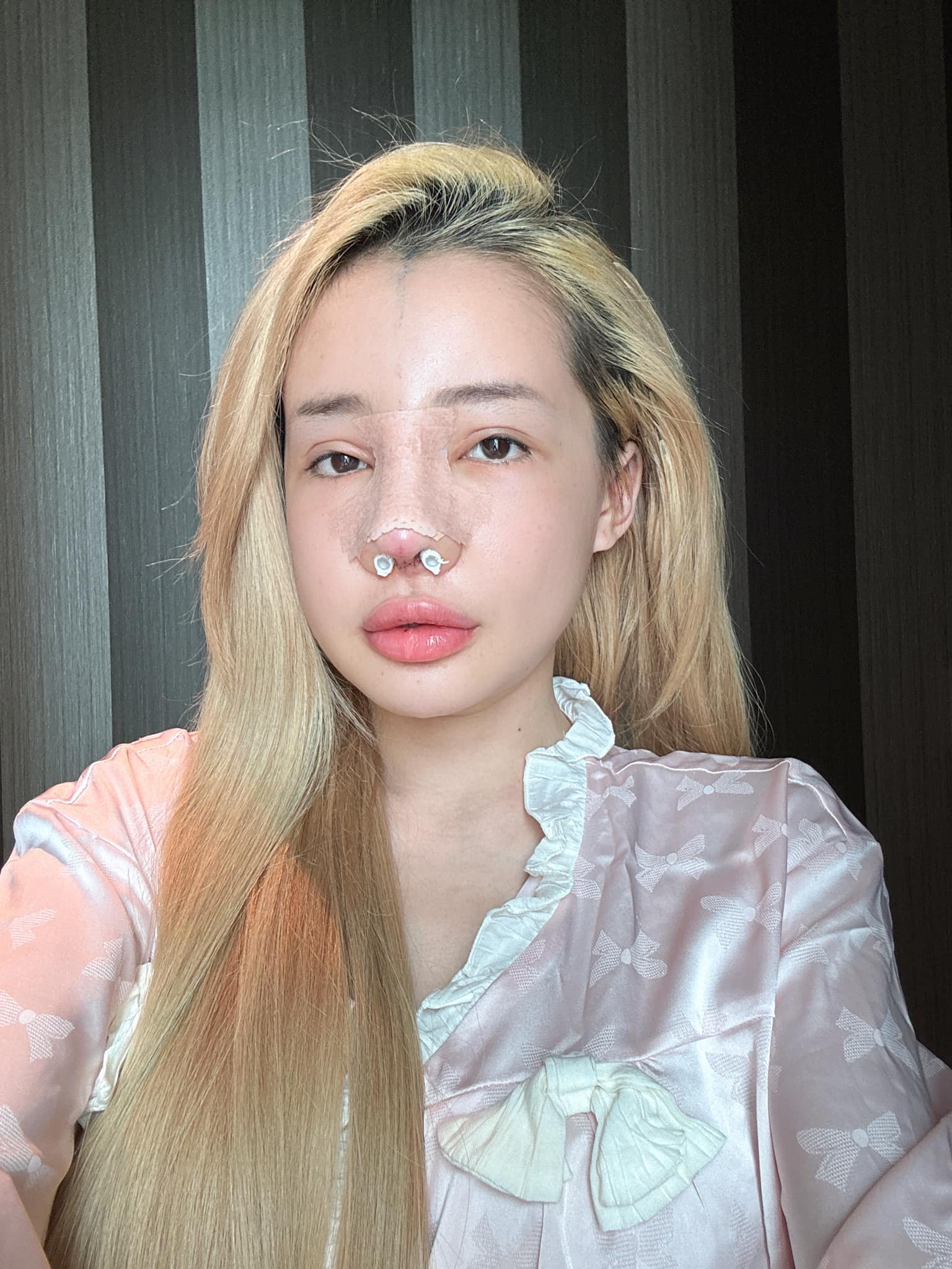 Ngân 98 