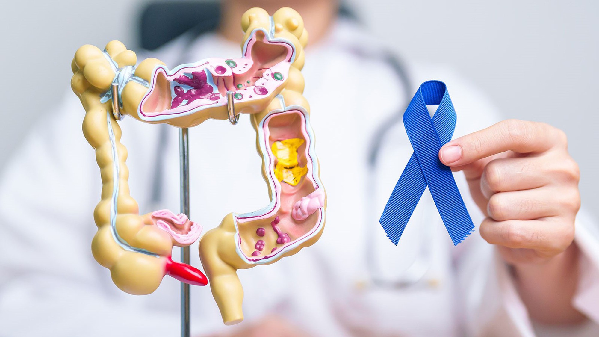 Ung thư không tấn công bừa bãi mà đặc biệt "để mắt" đến 3 nhóm người sau- Ảnh 1.
