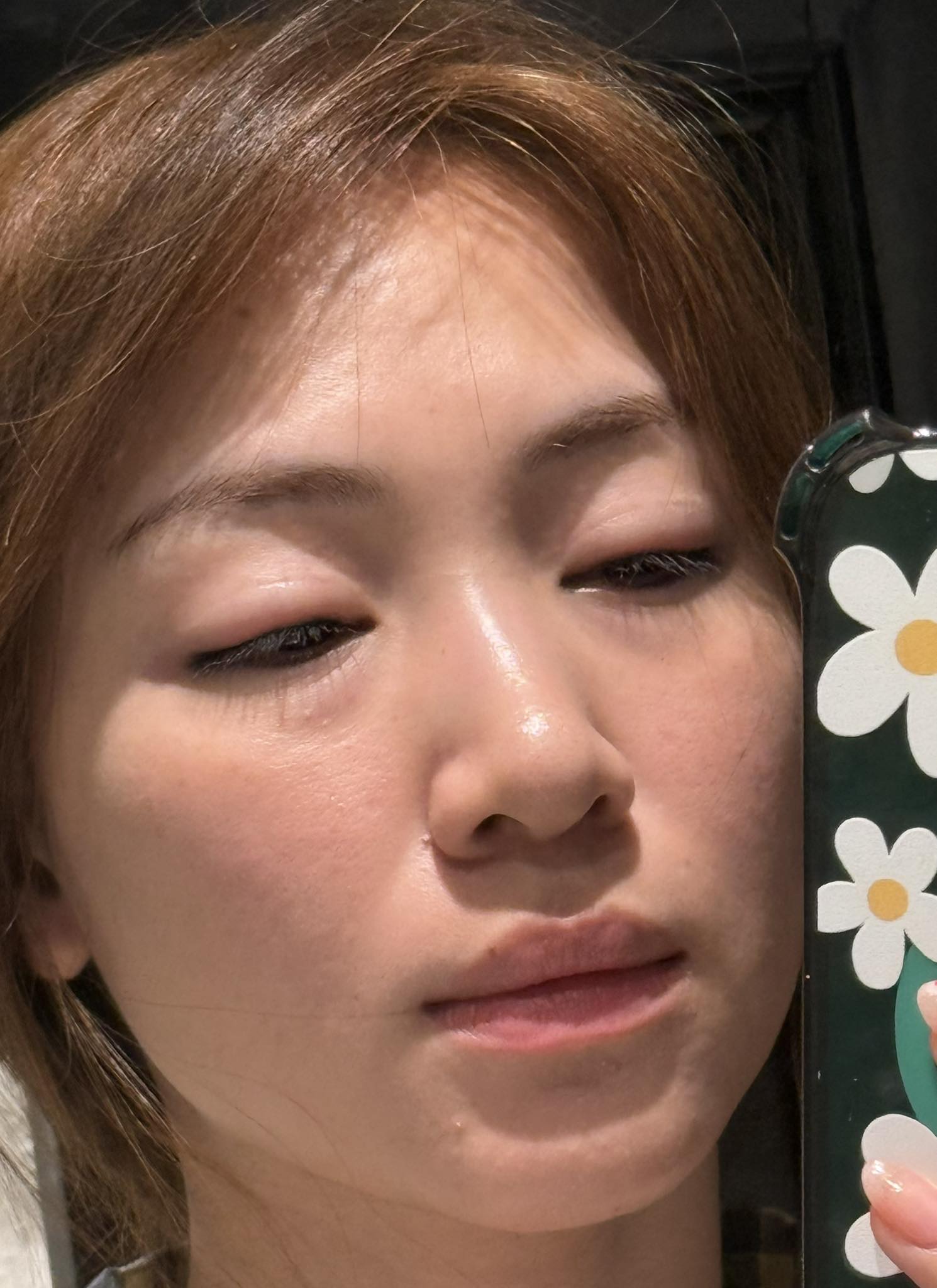 Hoà Minzy lộ nhan sắc sưng phù gây sốc- Ảnh 4.