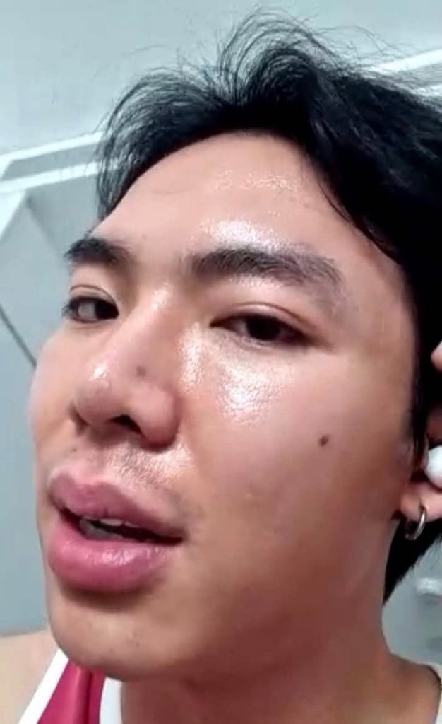 Hoà Minzy lộ nhan sắc sưng phù gây sốc- Ảnh 3.