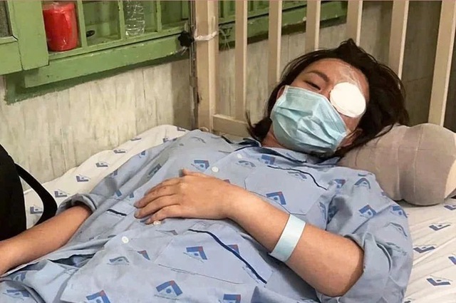 Cô gái bị người yêu cũ đánh gục trong quán cà phê, tổn thương 23% cơ thể: Yêu cầu bồi thường 900 triệu đồng- Ảnh 2.