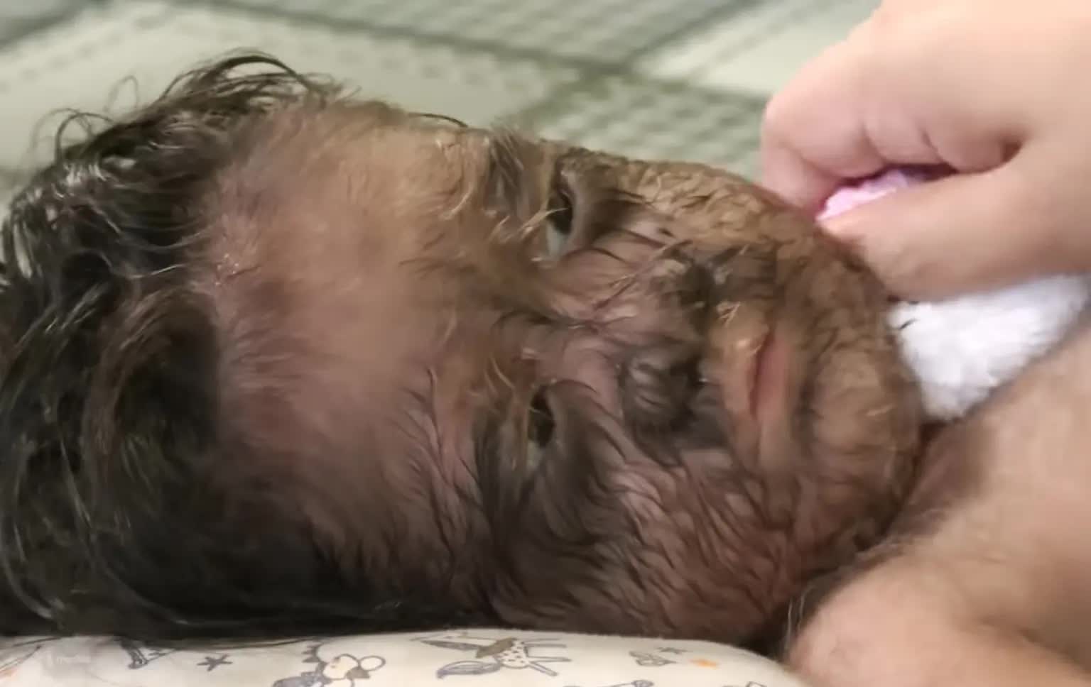 Vì sao bé gái "người sói" đầy lông lá này được gọi là "đứa trẻ đến từ thiên đường"?- Ảnh 1.