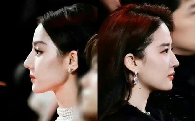 Những chiếc mũi khiến visual thăng hoa của dàn mỹ nhân Hoa ngữ, 1 nhân vật gây tranh cãi- Ảnh 4.