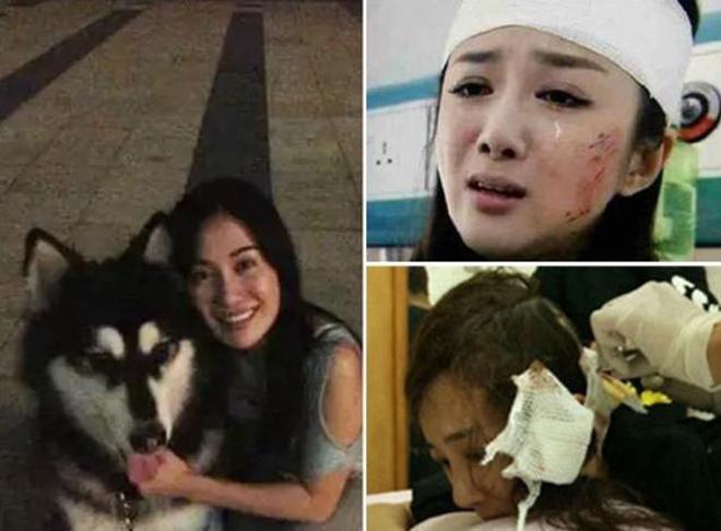 Cuộc sống hiện tại của nữ diễn viên từng là mỹ nhân cổ trang, bị chó cắn hủy dung- Ảnh 1. Cuộc sống hiện tại của nữ diễn viên từng là mỹ nhân cổ trang, bị chó cắn hủy dung- Ảnh 1.