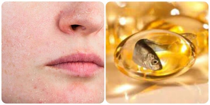 5 dấu hiệu cho thấy cơ thể bạn đang thiếu Omega-3- Ảnh 1.