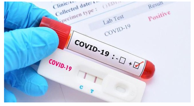 NÓNG:  83% mẫu COVID-19 tại TP HCM là biến chủng mới NB.1.8.1- Ảnh 1.