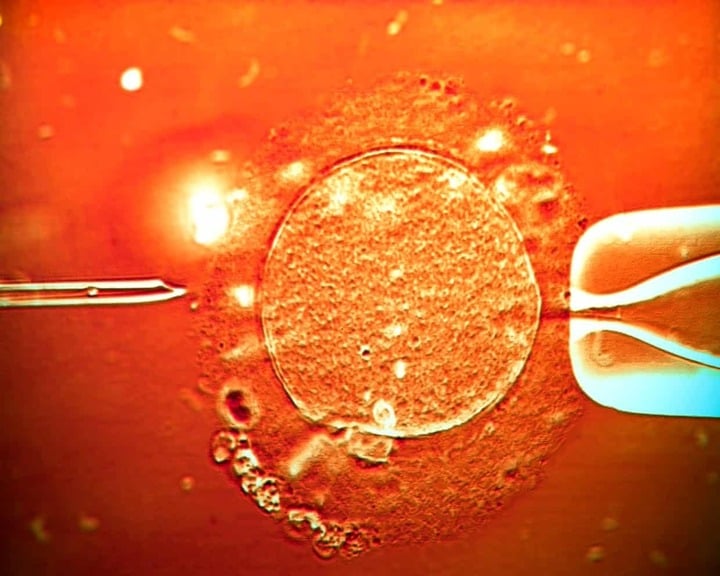 67 trẻ sinh ra từ tinh trùng người hiến mang gene ung thư, 10 trẻ mắc bệnh- Ảnh 1.