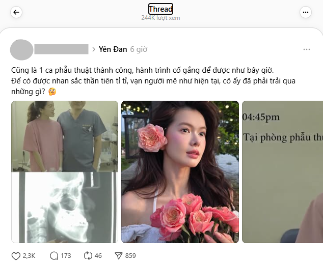 Yên Đan - “công chúa của SOOBIN”: Ngỡ ngàng diện mạo trước khi phẫu thuật- Ảnh 5.