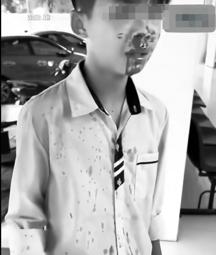 Hai học sinh "tr&ecirc;u nhau", phụ huynh đ&aacute;nh nam sinh lớp 7 nhập viện: Clip h&eacute; lộ t&igrave;nh huống trước đ&oacute;- Ảnh 1.