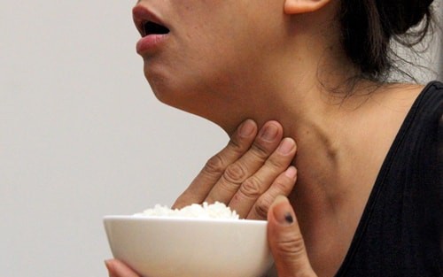 Bị nghẹn họng kéo dài tưởng bệnh dạ dày, người phụ nữ vô tình phát hiện tuyến giáp đã UNG THƯ- Ảnh 1.