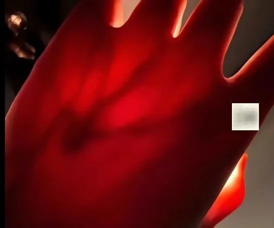 Cô gái đăng ảnh mình chiếu đèn pin vào tay, cư dân mạng phát hiện điều bất ổn- Ảnh 1.