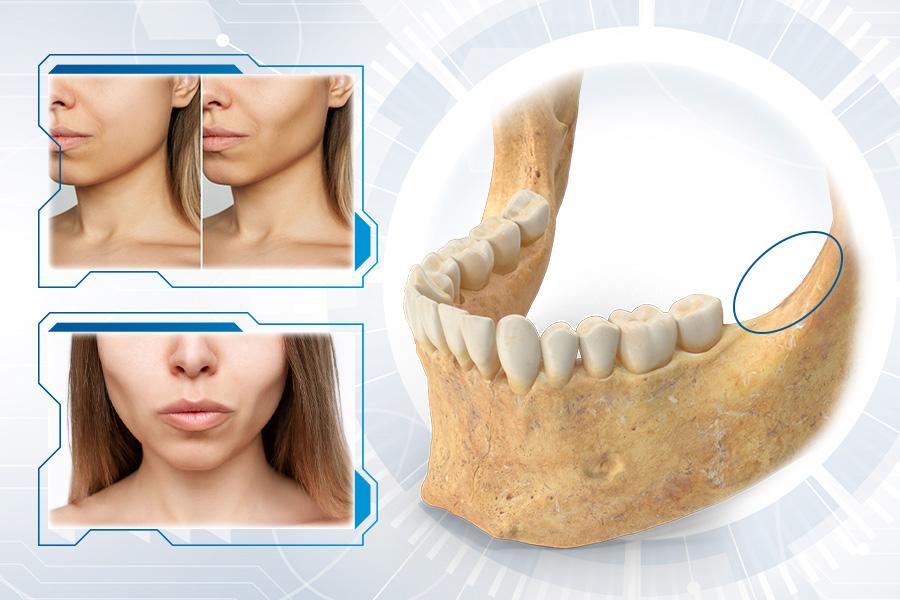 Tiêu chân răng là gì? Phân loại và cách điều trị- Ảnh 2.