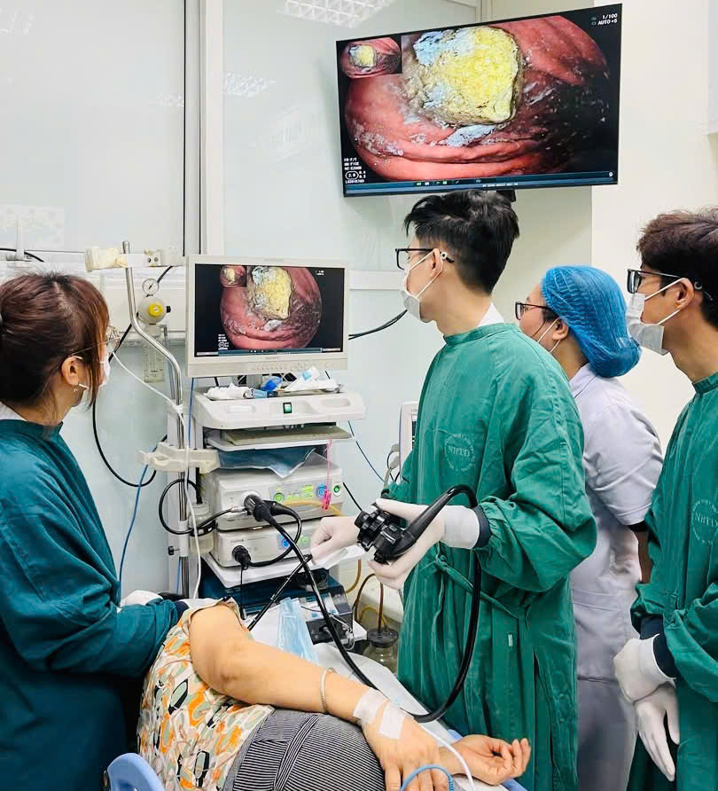 Kinh hoàng phát hiện bã thức ăn to bằng quả trứng trong dạ dày cụ bà do thói quen ăn các loại trái cây xanh- Ảnh 1.