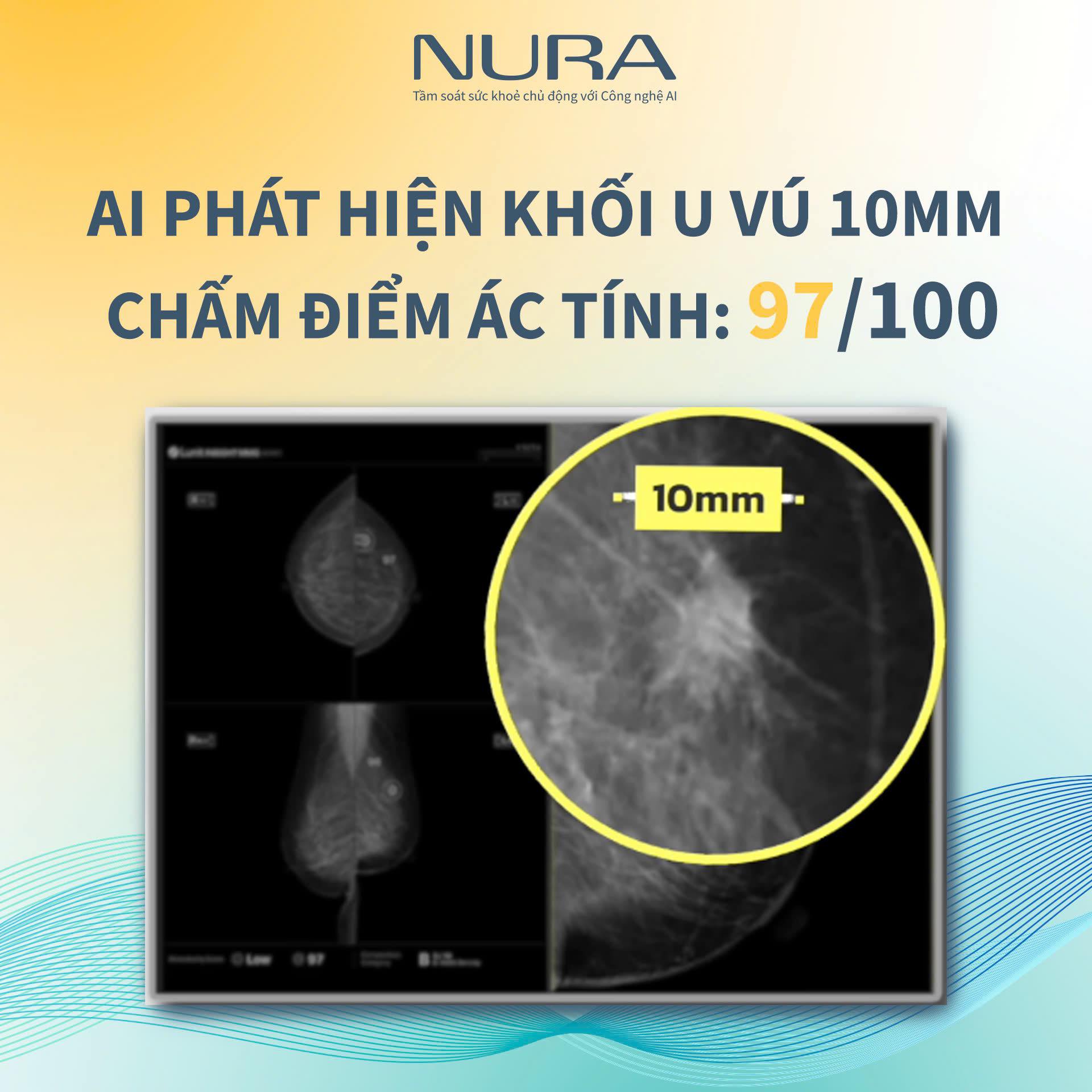 Một thiết bị hiện đại bậc nhất được các bác sĩ Nhật công nhận là chìa khóa vàng trong tầm soát ung thư đã có mặt tại Việt Nam- Ảnh 6.