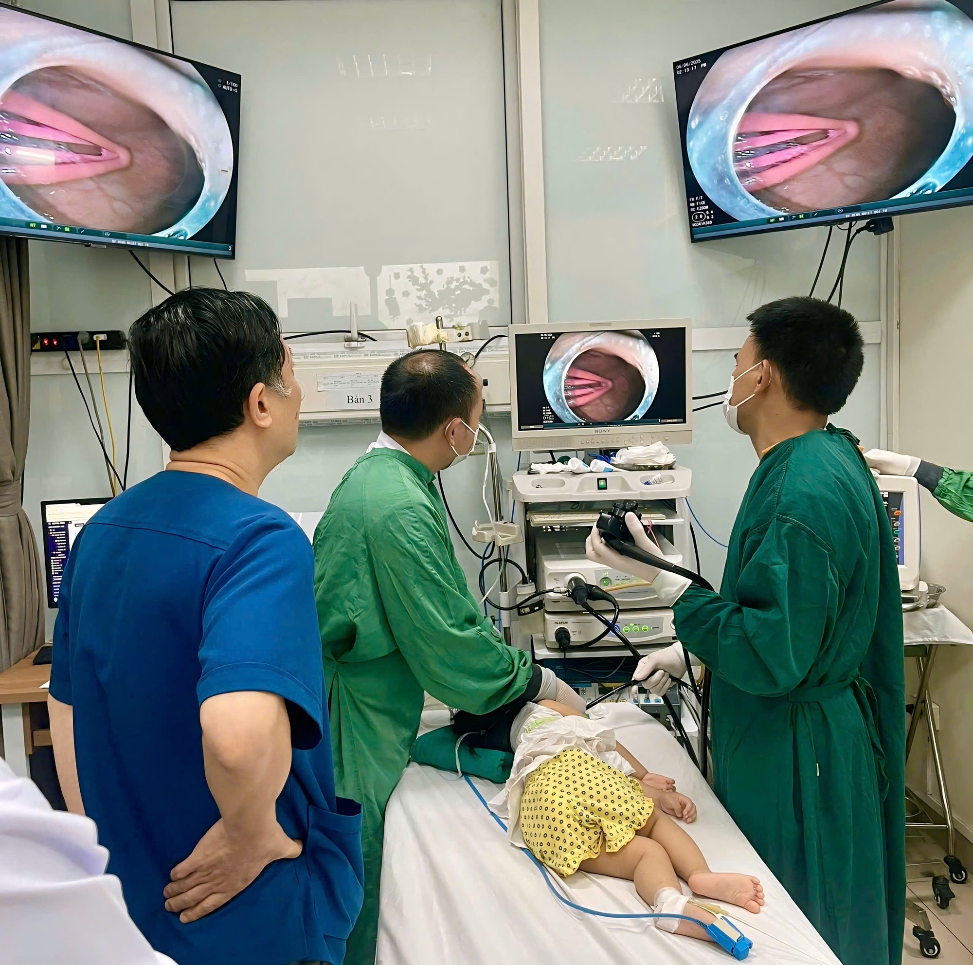 Hà Nội: Bé gái 21 tháng tuổi nhập viện sau khi nuốt một chiếc kẹp tóc kim loại- Ảnh 1.