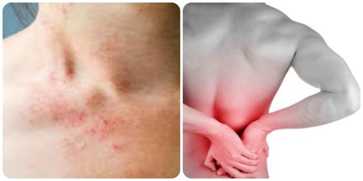 Những triệu chứng suy thận nhẹ bạn cần …