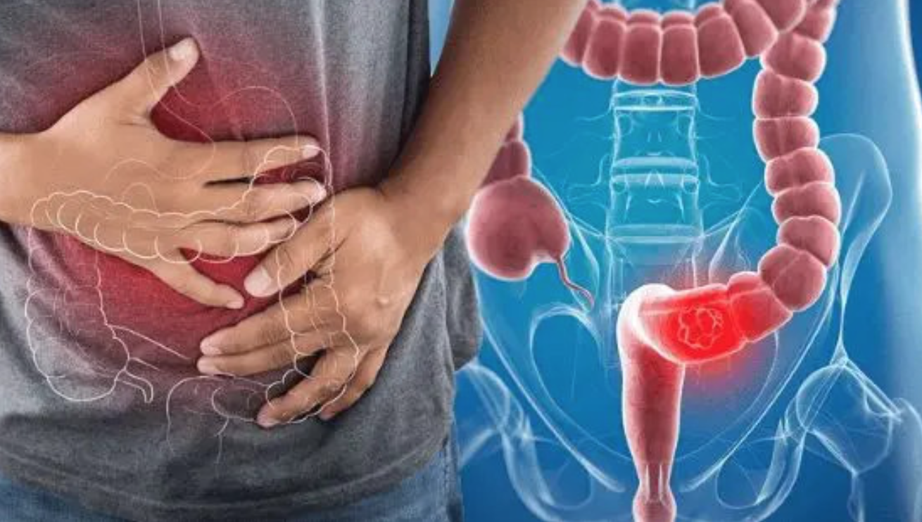 Bác sĩ Bạch Mai hé lộ “hạt giống” khởi nguồn cho ung thư, khuyên làm 1 việc để loại bỏ 90% nguy cơ- Ảnh 1.