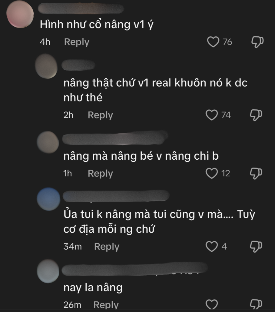 Bạn gái HIEUTHUHAI bị soi nâng cấp vòng 1- Ảnh 2.