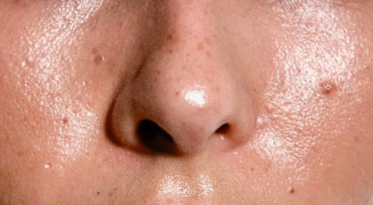 5 bước skincare kiềm dầu giúp da thoáng mịn cả ngày, nàng da dầu đừng bỏ lỡ!- Ảnh 1. 5 bước skincare kiềm dầu giúp da thoáng mịn cả ngày, nàng da dầu đừng bỏ lỡ!- Ảnh 1.