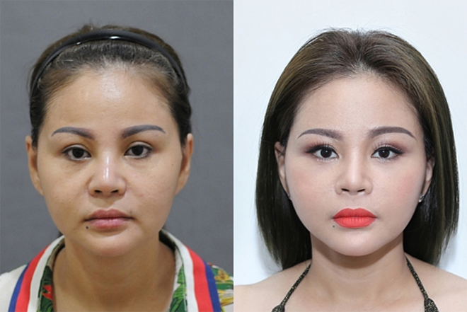 "Nữ hoàng dao kéo Vbiz" đến Ngân 98 cũng chịu thua: Sửa tới 20 lần, không còn muốn yêu sau 2 lần đổ vỡ- Ảnh 5.