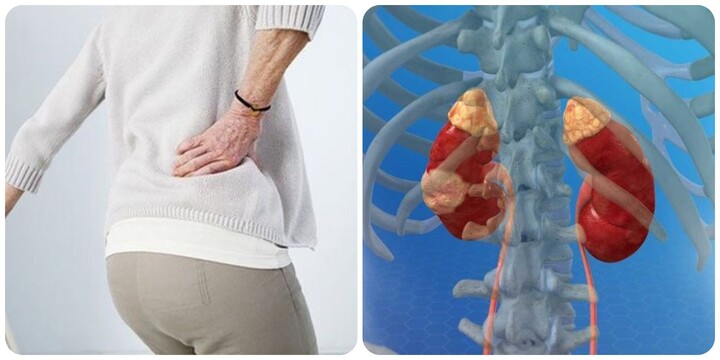 Triệu chứng ung thư thận giai đoạn cuối- Ảnh 1.