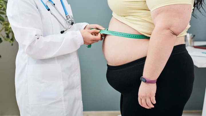 Tăng 35 kg trong một năm do 'ăn để xả stress'- Ảnh 1.