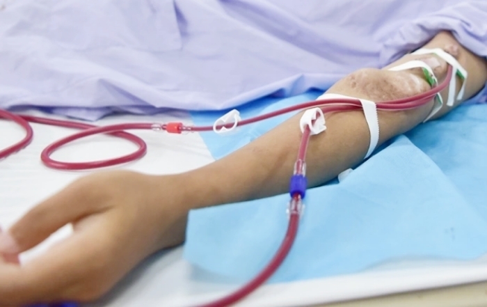 Suy thận ở tuổi 32 sau nhiều năm lạm dụng sản phẩm tăng cơ- Ảnh 1. Suy thận ở tuổi 32 sau nhiều năm lạm dụng sản phẩm tăng cơ- Ảnh 1.