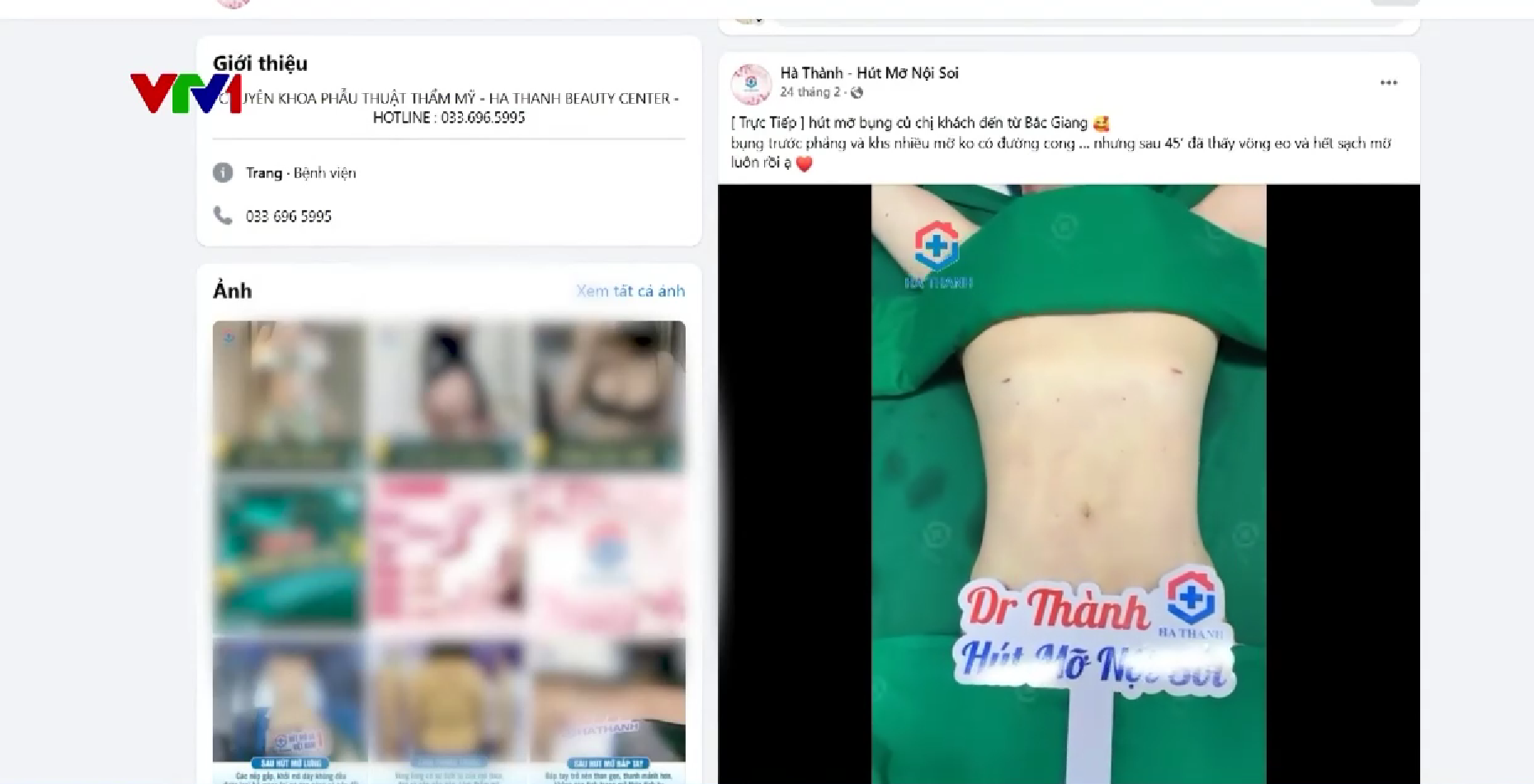 Hà Nội: Phát hiện cơ sở thẩm mỹ trái phép hút mỡ cho hàng trăm người- Ảnh 4.