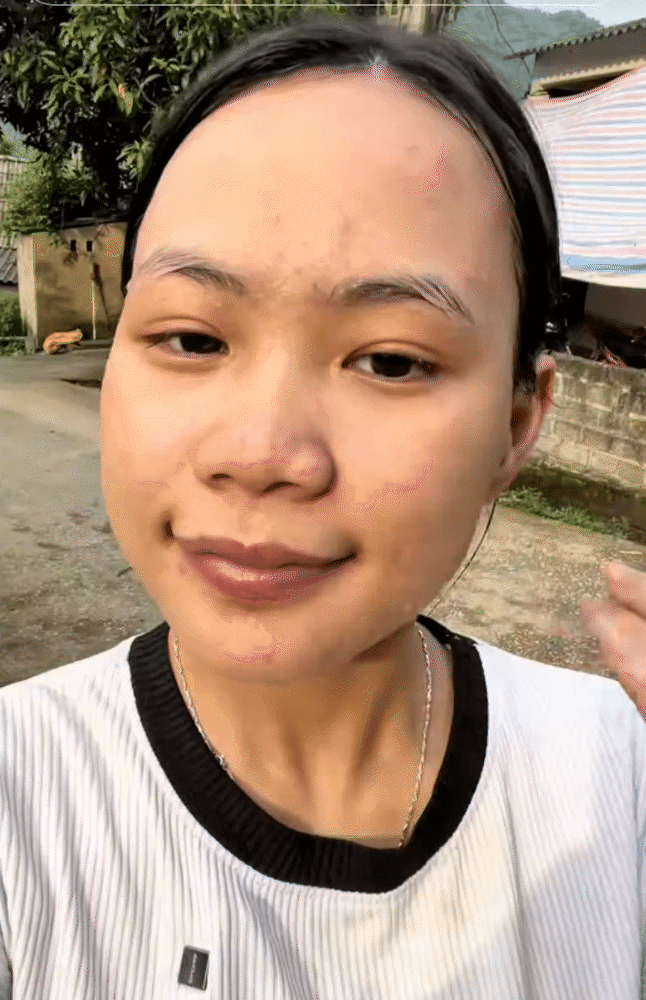 Da chi chít mụn do 5 năm rửa mặt sai cách, cô nàng chữa lành làn da bằng loại hạt mà mọi người vứt bỏ- Ảnh 15.
