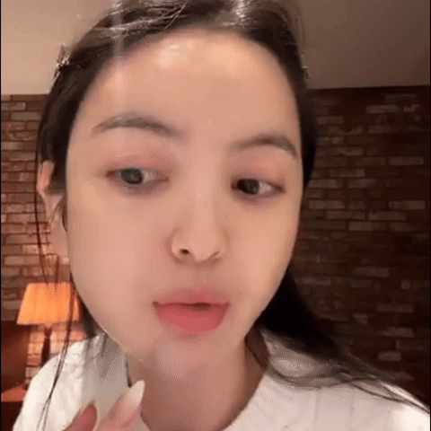 Chu Thanh Huyền lộ cằm bầm tím trên livestream, netizen tiếc thay nhan sắc thời chưa 