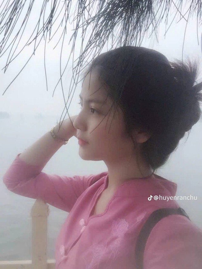 Chu Thanh Huyền lộ cằm bầm tím trên livestream, netizen tiếc thay nhan sắc thời chưa 