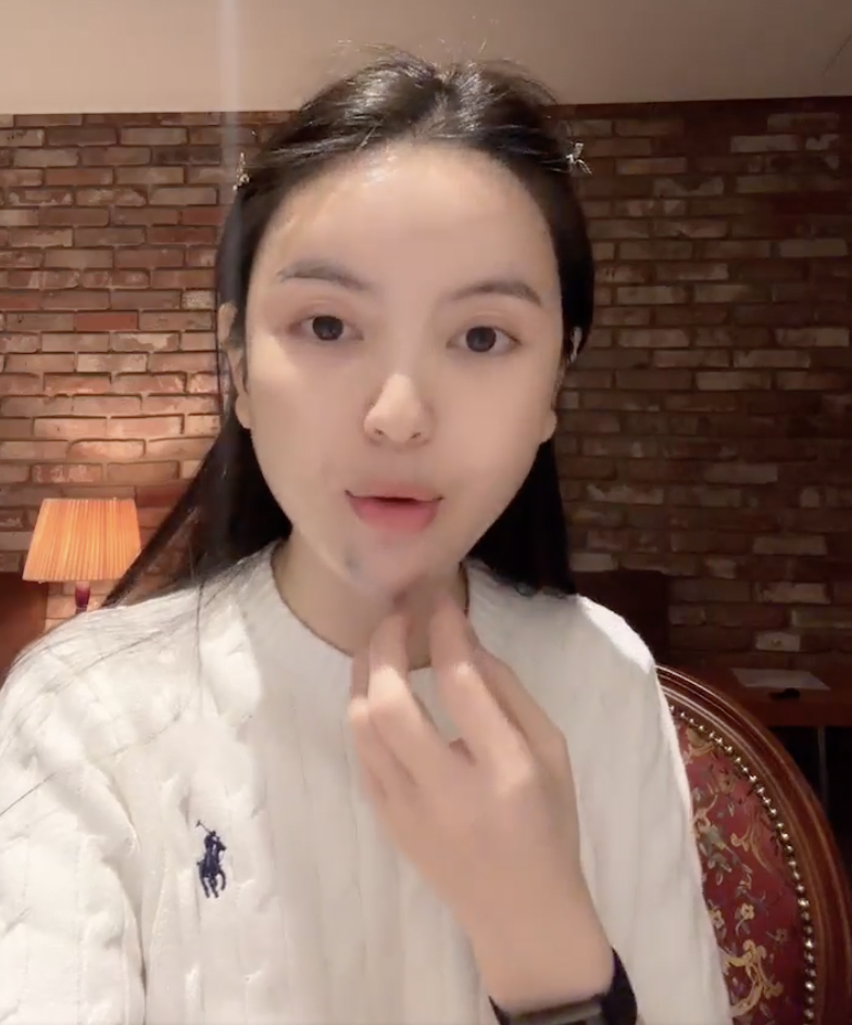 Chu Thanh Huyền kể lại trải nghiệm kinh hoàng khi đi xử lý hậu quả phẫu thuật thẩm mỹ- Ảnh 1. Chu Thanh Huyền kể lại trải nghiệm kinh hoàng khi đi xử lý hậu quả phẫu thuật thẩm mỹ- Ảnh 1.