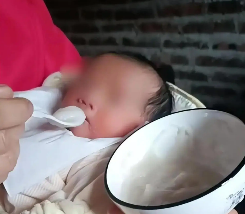 Bé gái 5 tháng tuổi đến viện với chiếc bụng toàn sỏi, bác sĩ kinh hoàng khi biết việc bố mẹ làm từ lúc bé mới sinh 3 ngày- Ảnh 3.
