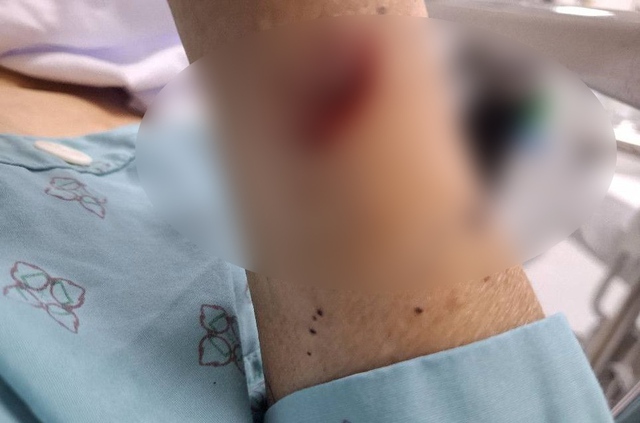 2 phụ nữ chém nhau bị thương nặng vì ghen tuông ở Thái Bình: Hé lộ tình trạng hôn nhân phức tạp- Ảnh 1. 2 phụ nữ chém nhau bị thương nặng vì ghen tuông ở Thái Bình: Hé lộ tình trạng hôn nhân phức tạp- Ảnh 1.