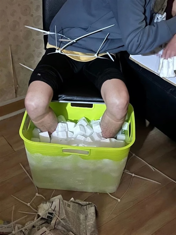 Ngâm chân trong đá để đòi tiền bảo hiểm, thanh niên vừa cụt chân vừa phải đi tù- Ảnh 1.