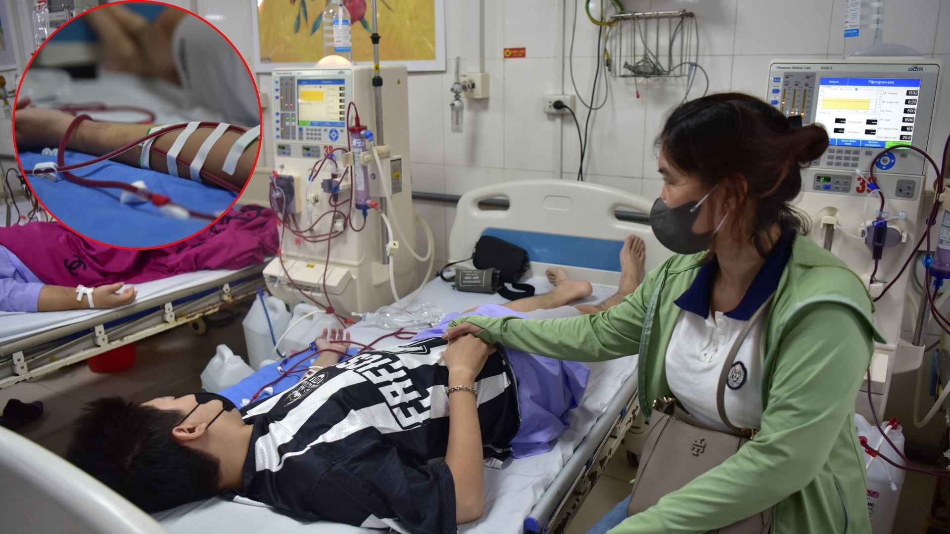 24 tuổi đã suy thận giai đoạn cuối: Chỉ vì 1 sai lầm mà khiến cơ thể phải 'trả giá đắt'- Ảnh 1.