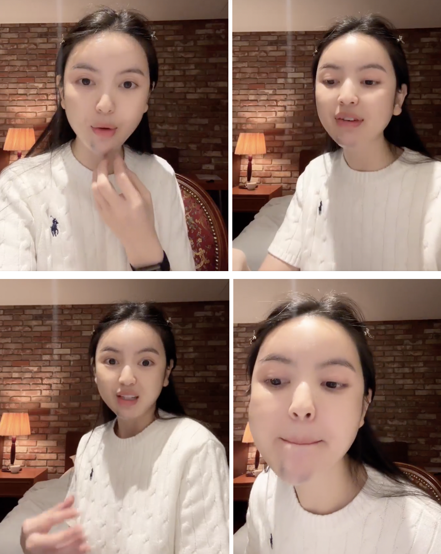 "Cam thường" soi rõ Chu Thanh Huyền với cằm tím tái hậu "trùng tu" nhan sắc, ra sân cổ vũ Quang Hải gây chú ý- Ảnh 3.