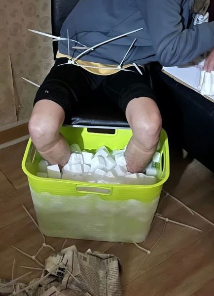 Nam sinh viên phải cắt cụt chân sau 10 tiếng ngâm đá khô, hé lộ âm mưu "động trời"- Ảnh 1.