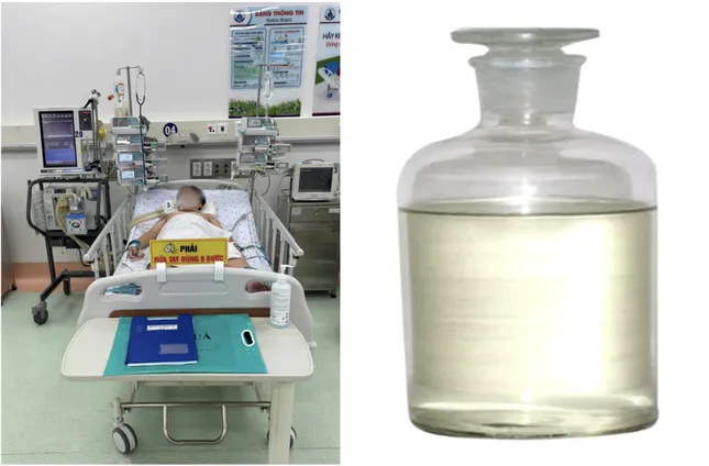H&iacute;t phải kh&iacute; kịch độc trong xe hơi, b&eacute; trai nguy kịch- Ảnh 1.