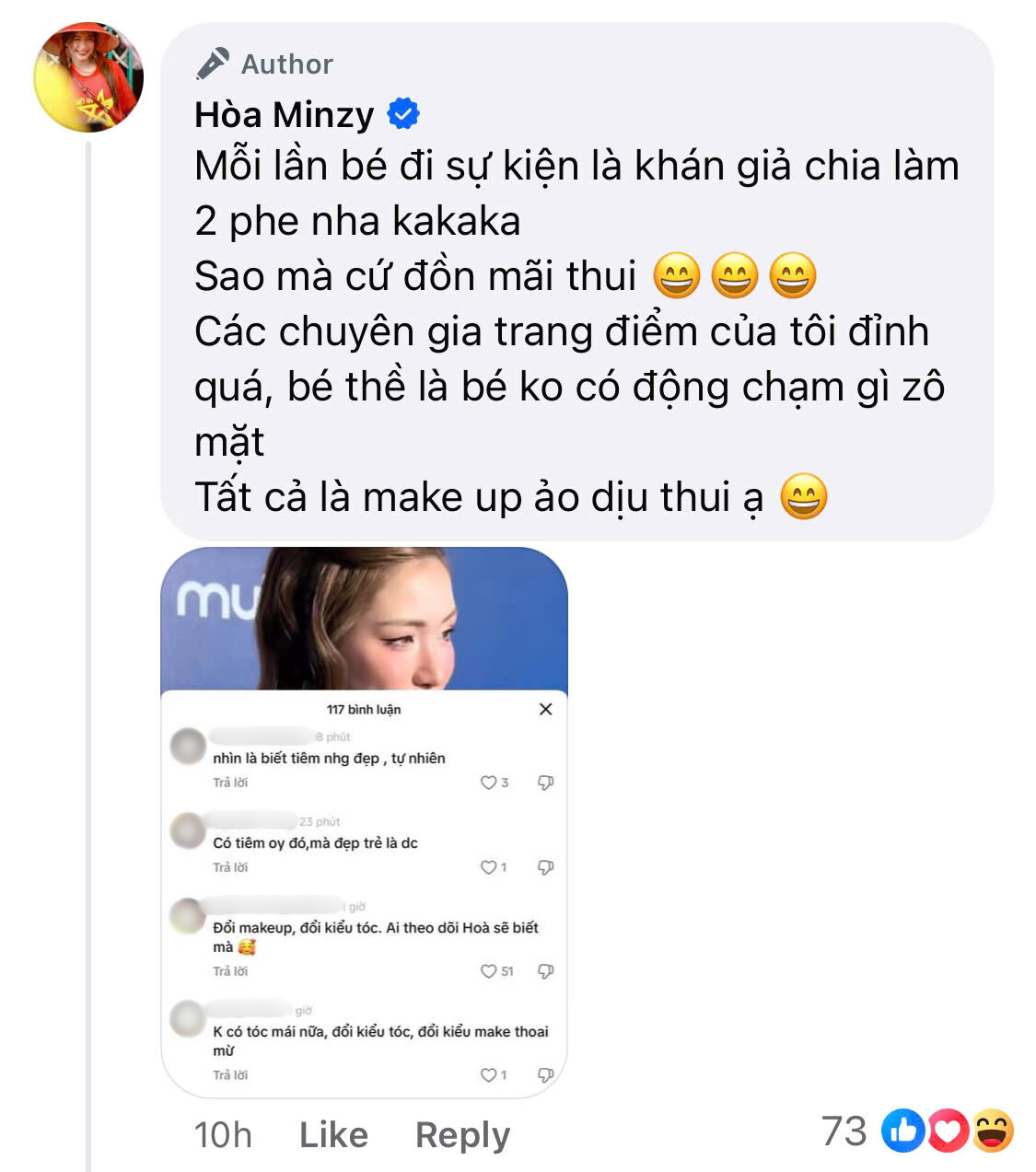 Điểm yếu khuôn mặt của Hòa Minzy- Ảnh 4.