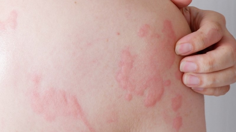 Bác sĩ chỉ ra sai lầm “chết người” về một căn bệnh mà nhiều người vẫn vô tư điều trị tại nhà- Ảnh 1.