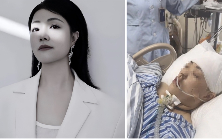 Nữ ca sĩ qua đời vì đột quỵ ở tuổi 48: Lời cảnh tỉnh cho nhiều người trẻ đang chủ quan với lối sống hiện đại- Ảnh 1.