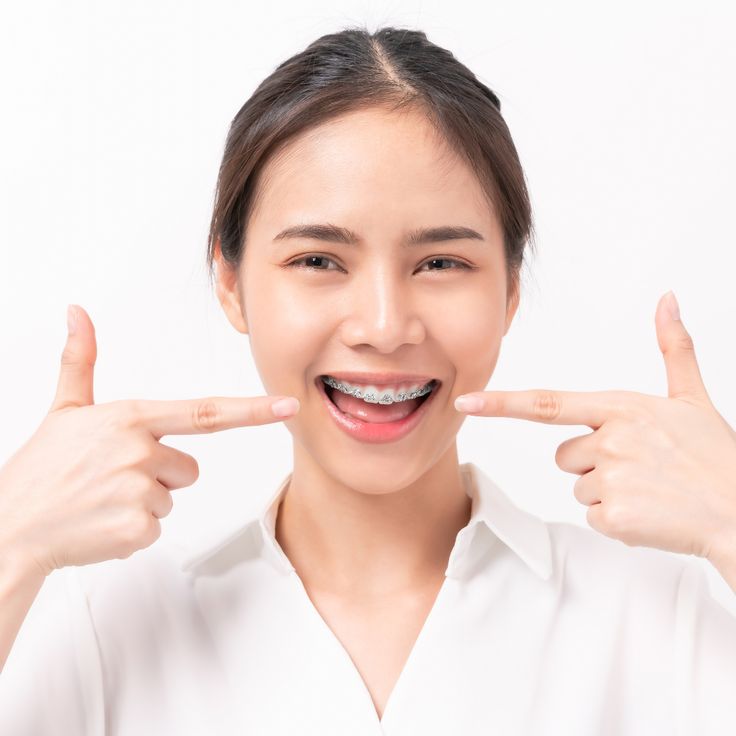 100 triệu để đổi nụ cười: Liệu có đáng không?- Ảnh 3.